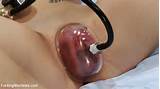 She Squirts In A Medical Fucking Scene Pussy And Nipple Suction Use