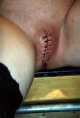Related Tags Pussy Masochism Needleplay Sewing Of Pussy Is A