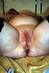 Related Tags Pussy Masochism Needleplay Sewing Of Pussy Is A
