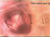 Camera Films Orgasm Inside The Vagina Xxxbunker Com Porn Tube