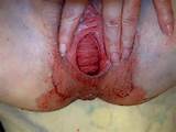 100 1013 Jpg In Gallery Wife Bleeding Pussy PERIOD Picture 8