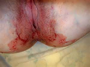 Wife Bleeding Pussy PERIOD Porn Pics All Amateur Porn