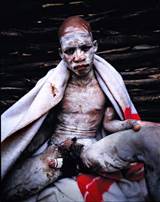 Xhosa Food Projects Xhosa Circumcision