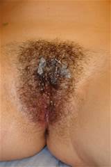 Cum Sticky In Pussy Hair Hairy Hardcore Pics Mature Hairy Pussy