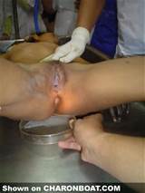 Autopsy9 Jpg