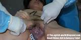 Naked Girl Autopsygirl Pussy Autopsy