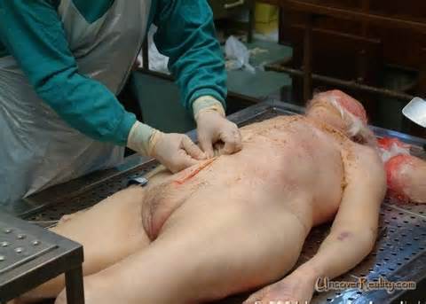 Dead Woman Autopsy Dead Woman Autopsy Your Source For Death Pictures