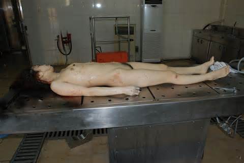 Girl Pussy Autopsy