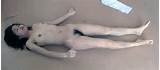 Naked Girl Autopsy