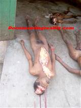 Autopsy On A Female Corpse