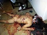 Naked Girl Autopsy Dead Girl Pussy
