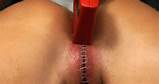 Sm Bdsm Torture Tortured Cunt Pussy Vagina Pain Punished Tortured