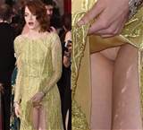 Emma Stone Pussy Upskirt Oscars