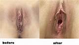 Milf4bbcstretch White Pussy Before And After