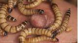 Skinny Woman Inserts Worms Up Her Vagina From Queensnake