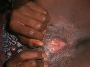 West African Pussy Circumcised Women MOTHERLESS COM