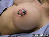 The Titty Is Infected Crazyshit Com