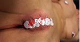 Bloody Stapler Pricking Free BDSM Pricking Porn Pussy Pics