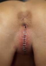 Pussy Sewn Stapler Sado Gate BDSM Sewing Sadism Masochism Pics