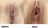 You Are Welcome To Write To My Email Louiseskouwils Hotmail Com
