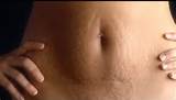 Short Film On Accepting The Body S Changes After Giving Birth