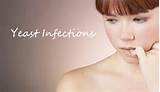 Home Remedies For Yeast Infections Women S Health Fast Home