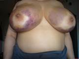 Jpg In Gallery Huge Udder Tits Bruised N Beaten Asian Piss Picture